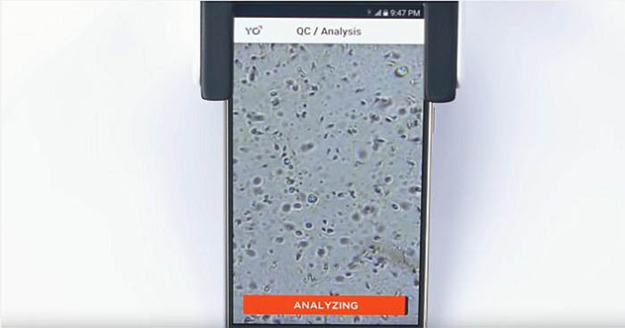 Analisis de los espermatozoides con una app