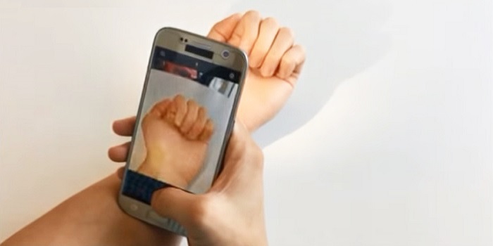 app detecta anemia Android